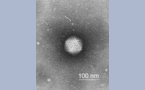 Adenoviridae Human adenovirus C, x29700