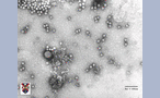 Adenovirus and adeno-associated virus, x250000