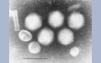 Adenoviridae Human adenovirus C, x29700