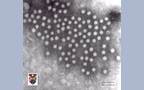 Astrovirus, x250000
