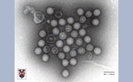 Egg drop syndrom virus, x250000